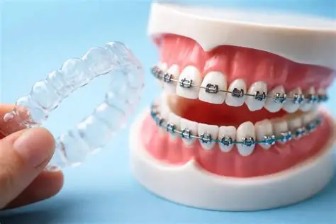 Orthodontic Braces